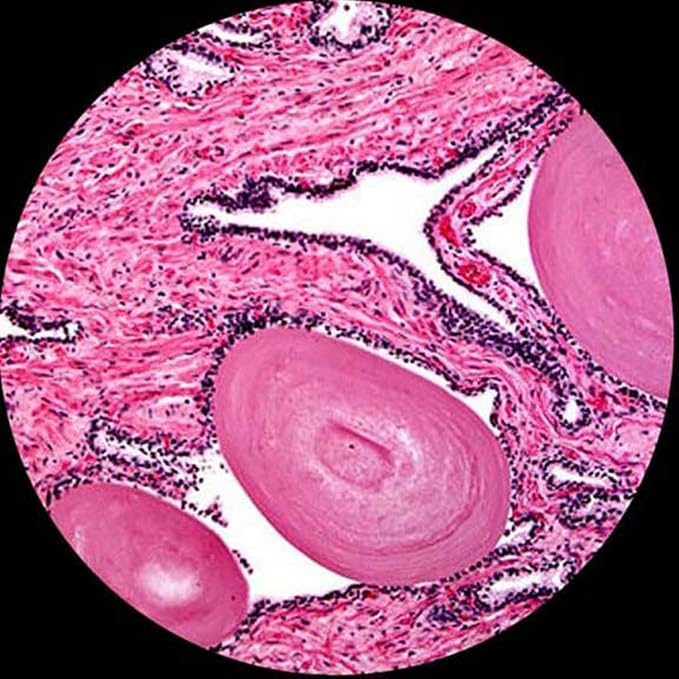 AmScope M620A Compound Monocular Microscope, WF10x and WF16x Eyepieces, 40x-1600x Magnification, Brightfield, LED Illumination, Abbe Condenser, Mechanical Stage, 110V